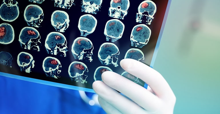 Service Detail Image, Best Oncologist in hyderabad, cancer treatment hyderabad, best cancer doctor in hyderabad
